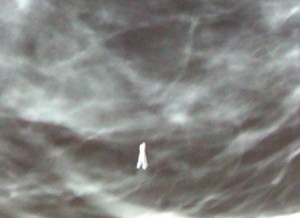 My Titanium Chip My Titanium Chip